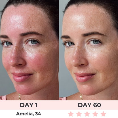 Dentoora™ - LED Face Mask